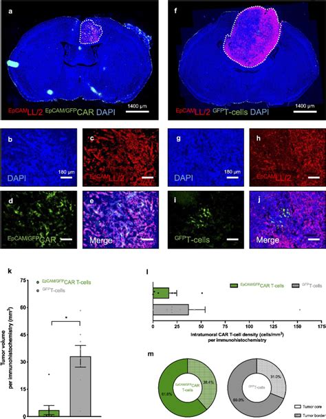 Immunofluorescence Characterization Of Tumor Growth And Intratumoral