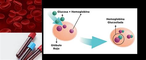 Hemoglobina Glicosilada Qu Es Valores Normales Y C Mo Bajarla