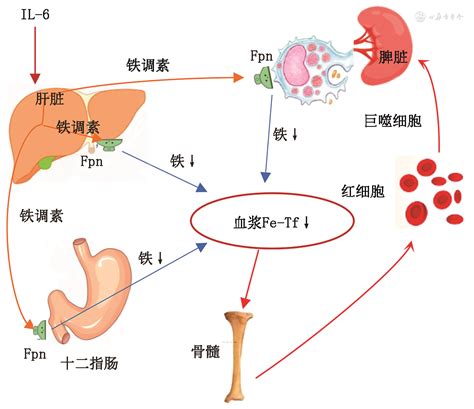 铁缺乏症和缺铁性贫血诊治和预防的多学科专家共识（2022年版） 中华医学杂志