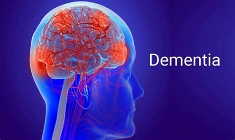 FnF Doc — Dementia Stages And Symptoms Briefly Explained