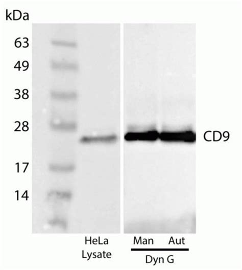 Dynabeads Protein G For Immunoprecipitation Thermo Fisher Scientific