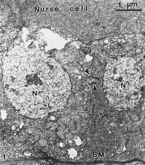 Thin Section Cut Through Two Adjacent Epithelial Cells In A Stage 10