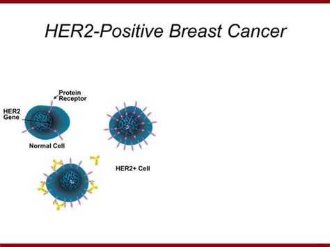 Metastatic Breast Cancer Research And Treatment Ppt