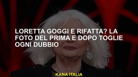 Loretta Goggi Rifatta La Foto Del Prima E Dopo Toglie Ogni Dubbio