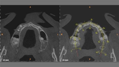 Tomografia Cone Beam