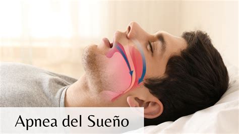 Apnea obstructiva del sueño desde la Biodecodificación YouTube