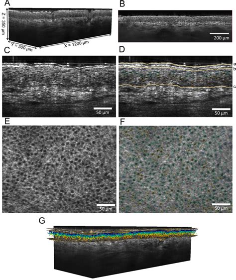 LC OCT Coupled To AI Applied To Imaging Of Healthy Human Face Skin A