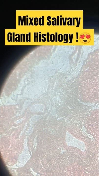 Mixed Salivary Gland Histology 😍 Histology Salivaryglands Saliva