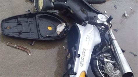 Un Joven Motociclista Sufrió Fracturas Expuestas Al Chocar Contra Una