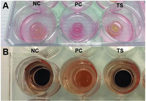 The View Of 3D Reconstructed Human Skin Inserts During In Vitro Skin