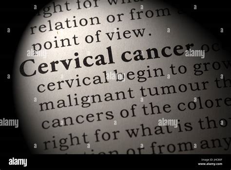 Fake Dictionary Dictionary Definition Of The Word Cervical Cancer