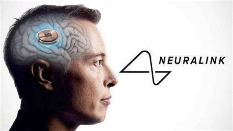 Historique Neuralink d Elon Musk implante avec succès son premier