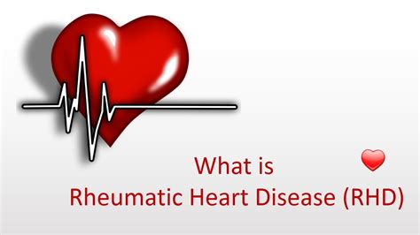 Rheumatic Heart Disease Symptoms Rheumatic Symptoms Diseases Club Center 2