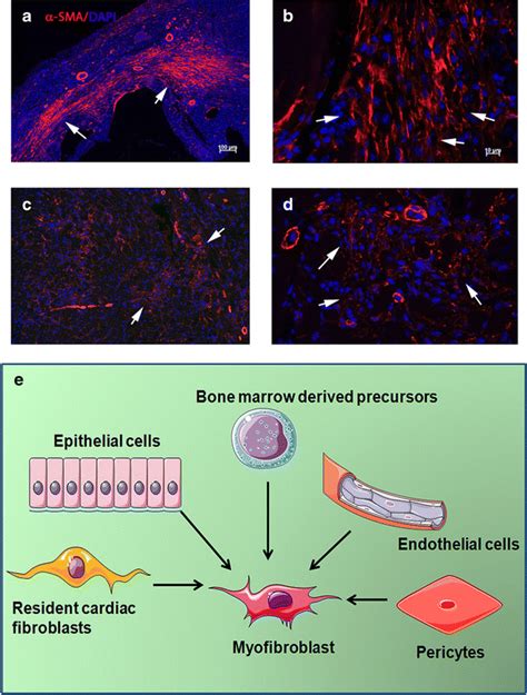 Myofibroblasts in the infarcted and remodeling myocardium αSMA