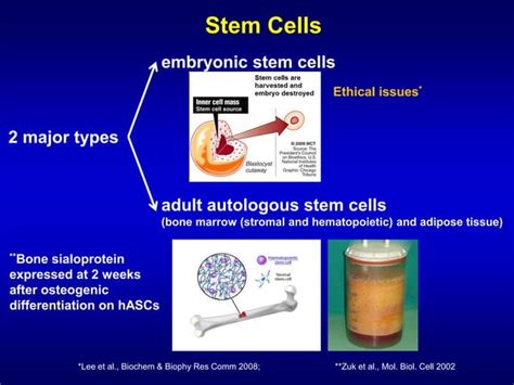 Osteoinduction Of Human Adipose Stem Cells On Plla Scaffolds