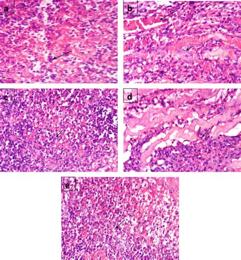 Histopathology Photomicrographs In Tumor Tissue Of Control Group A Download Scientific