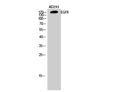 Anti-EGFR Antibody (A96210) | Antibodies.com