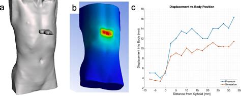 A D Printed Patient Specific Ultrasound Phantom For Fast Scan