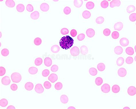 Human Blood Smear. Basophil Stock Photo - Image of basophil, leukocyte ...