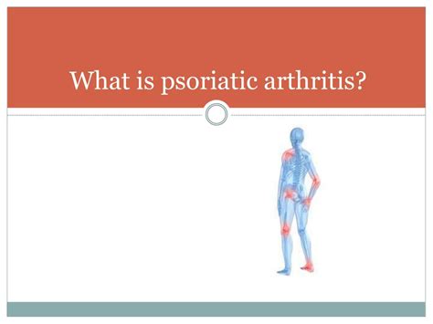 Ppt Psoriatic Arthritis Powerpoint Presentation Free Download Id