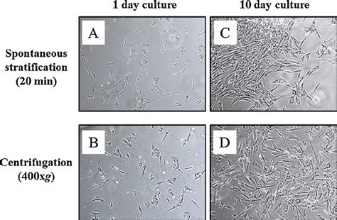 Morphology Of Adherent Cells From Digestion Of Middle Layer Adherent