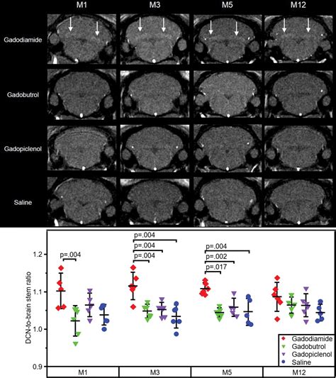 Long Term Gadolinium Retention In The Healthy Rat Brain Comparison