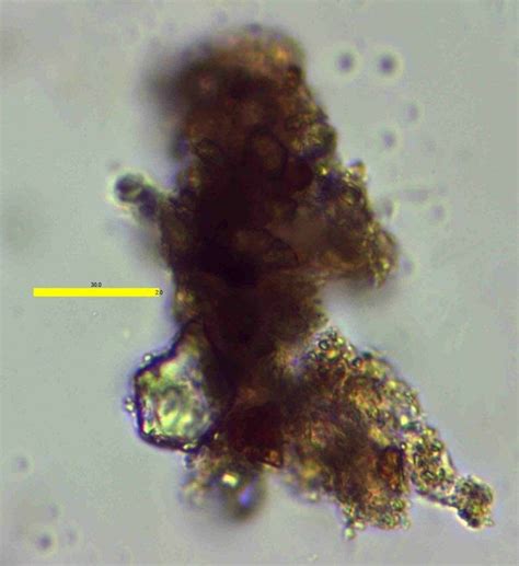 shows  fine silt layer   bloemfontein soil  figures