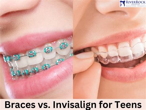 Braces Vs Invisalign For Teens Differences Benefits And Cost