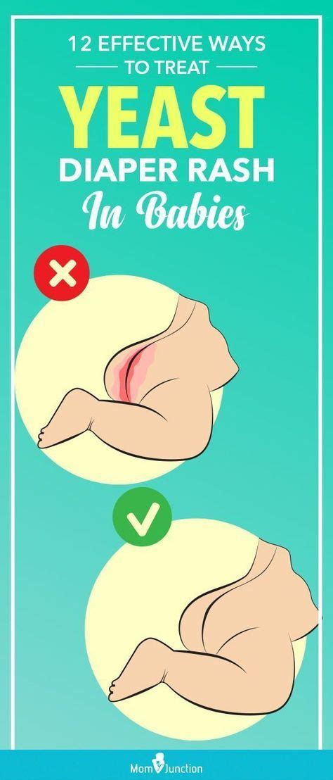 Effective Ways To Treat Diaper Rashes In Babies Diaper Rash Baby