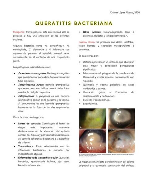 Queratitis Bacteriana IOVANNY CRUZ OJEDA UDocz