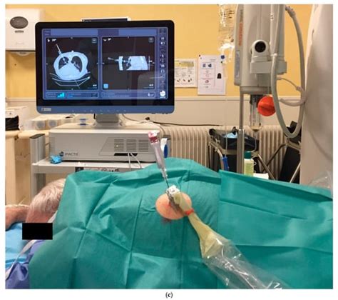 Diagnostics Free Full Text Computed Tomography Navigation