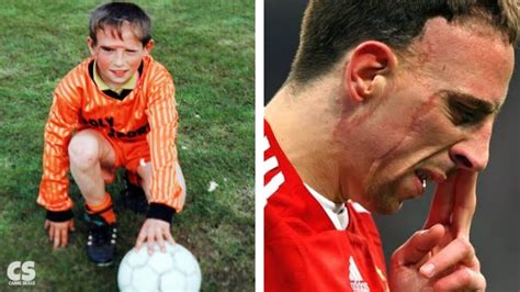 O Triste Motivo Por Trás Da Cicatriz De Franck Ribéry Youtube