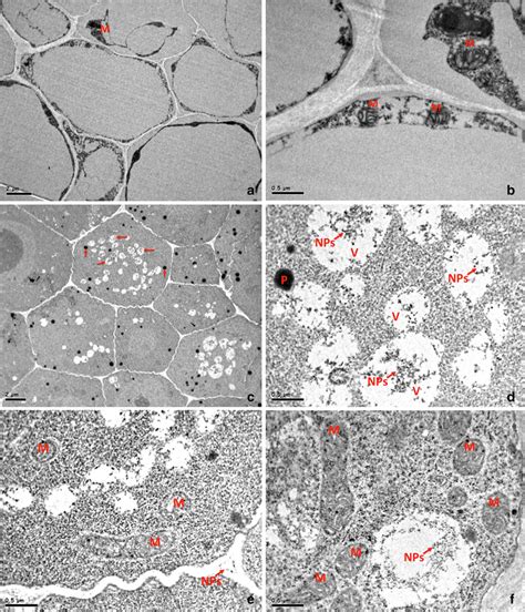 Tem Images Of Control Roots Showing The Triangular Shaped Parenchymal