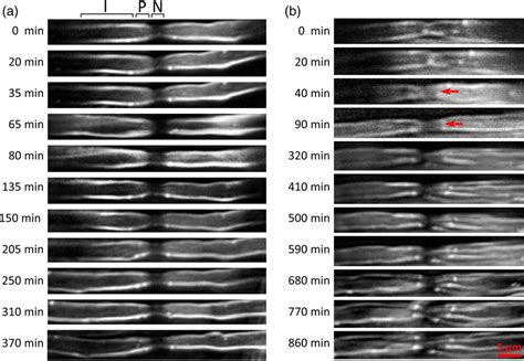 Peripheral Nerve Histology Nodes Of Ranvier