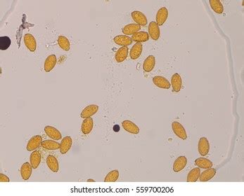 354 Liver Fluke Eggs Images, Stock Photos & Vectors | Shutterstock