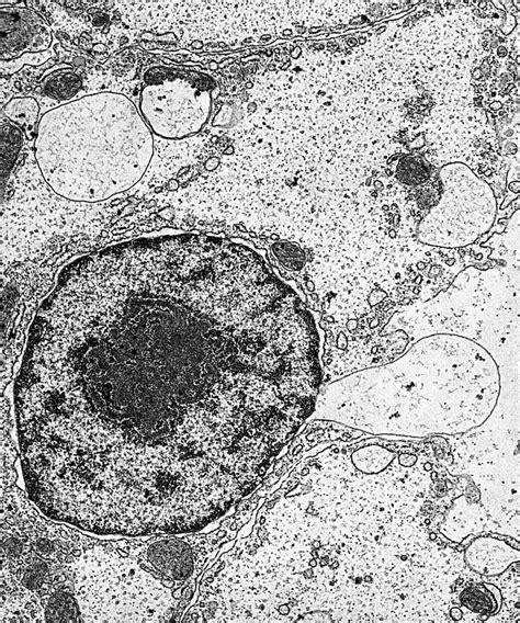 Núcleo Celular Y Organelles Bajo El Microscopio Electrónico Foto de