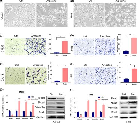 Arecolineinduced EMT And Enhanced Migration And Invasion Of OSCC