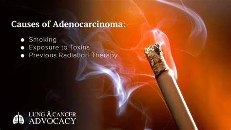 Adenocarcinoma - Lung Cancer Advocacy