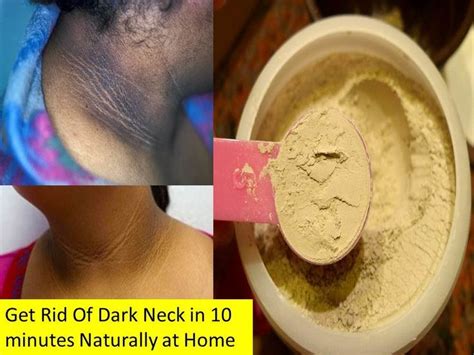 How To Get Rid Of Dark Neck In 10 Minutes How To Lighten Body Skin