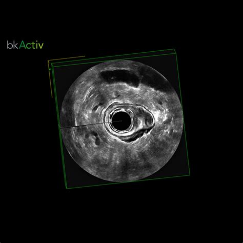 Anorectal Imaging Bk Medical