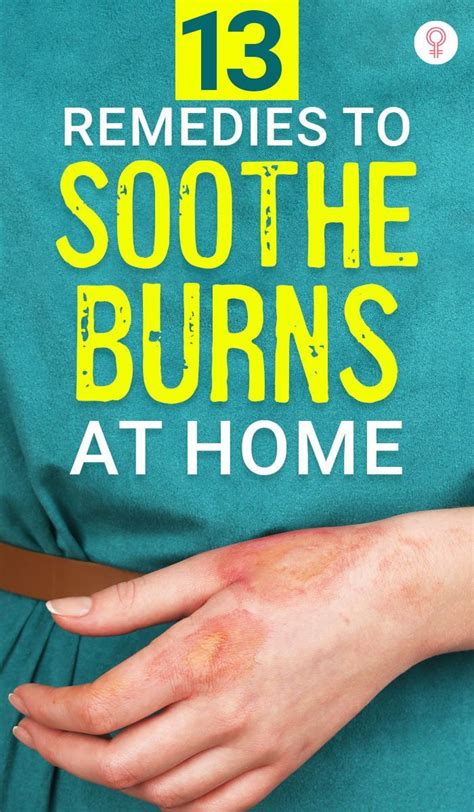 Home Remedies For Burns Artofit