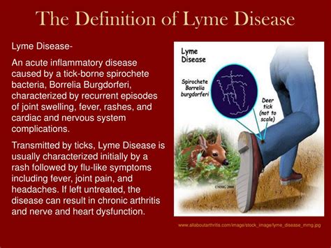 Ppt Lyme Disease Powerpoint Presentation Free Download Id 6961261