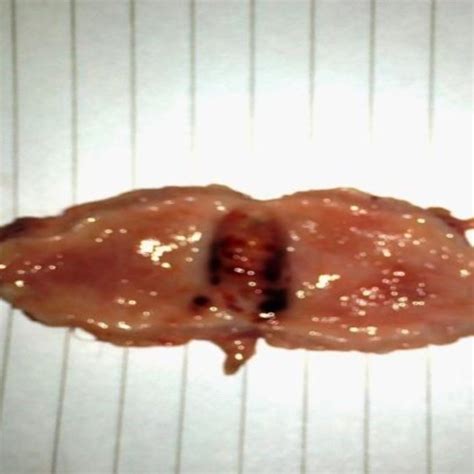 (PDF) evaluation of catgut as a suture material for cystotomy closure in canines