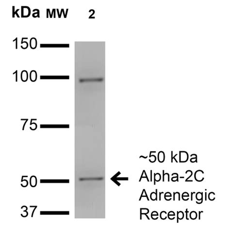 Anti C Adrenergic Receptor Antibody Leinco Technologies