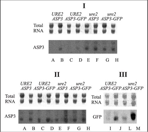 Northern Blot Of Asp Steady State Mrna Levels In Ure Fy C