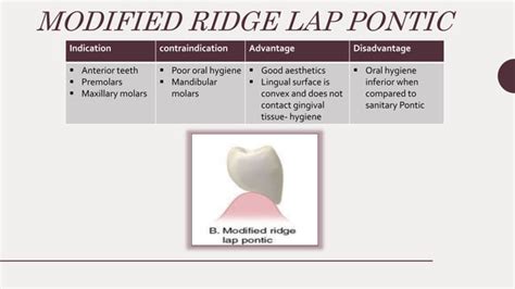 Parts of fixed partial denture | PPT