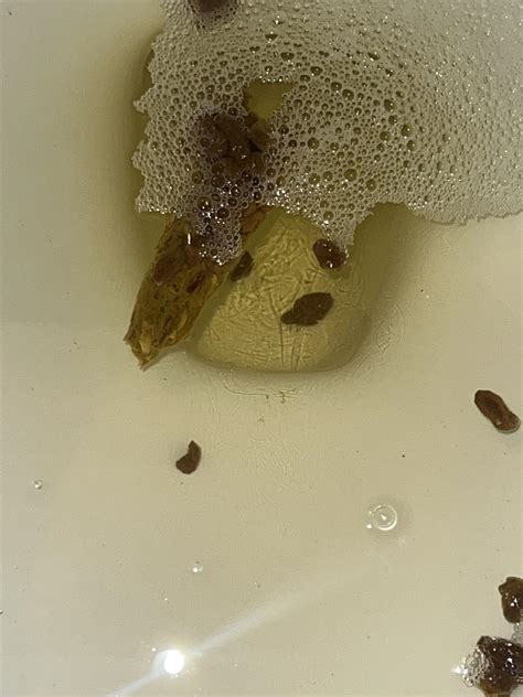 What Does My Poop Look Like It Can Be Rshittingadvice