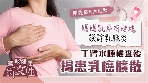 健康新女性︳媽媽乳房有硬塊誤診乳腺炎 手臂水腫檢查後揭患乳癌擴散 晴報 健康 腫瘤及癌症 D221001