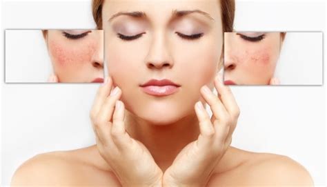 Effective Skincare Treatments For Enlarged Pores