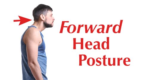 Forward Head Posture Dowagers Hump Hans Chiropractic And Acupuncture